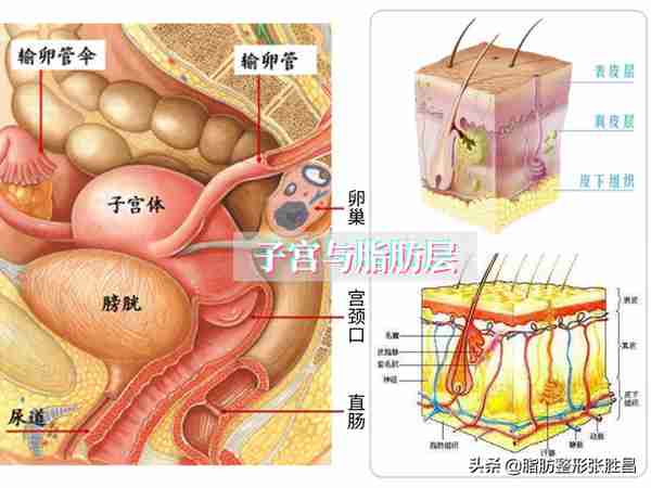 腰腹吸脂两个问题：术中需插尿管吗？术后影响怀孕吗？你了解一下