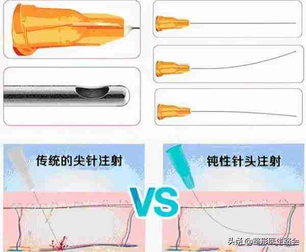 关于玻尿酸隆鼻、填充太阳穴、泪沟，那些医生不会告诉你的