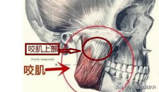 网上那么多“打完瘦脸针，出现面部僵硬、凹陷的”，我都不敢打了