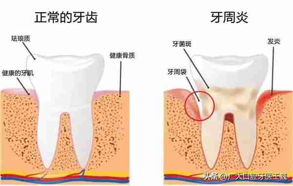 正畸必读｜除了排齐牙齿让你更美，牙齿矫正的8大好处你知道吗？