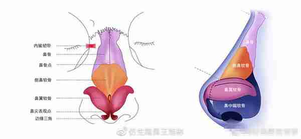 醒醒吧！L型假体隆鼻+耳软骨垫鼻尖，还在骗你是鼻综合