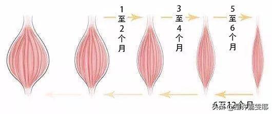 关于瘦脸针，你们想了解的都在这儿了