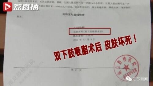 花6万元吸脂后皮肤坏死，双腿凹凸不平！还没修复好，整形医院去哪了？