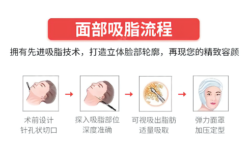 面部吸脂后应该做好哪些护理？